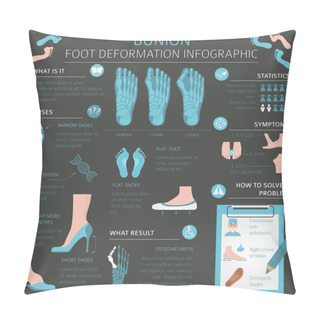 Personality  Foot Deformation As Medical Desease Infographic. Causes Of Bunio Pillow Covers
