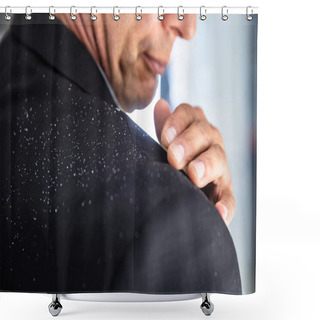 Personality  Close-up Of A Businessman's Hand Brushing Off Fallen Dandruff On Shoulder Shower Curtains