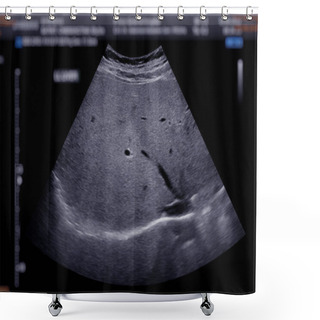 Personality  Ultrasound Upper Abdomen Showing  Liver. Shower Curtains