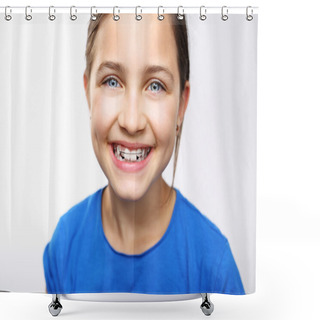 Personality  Beautiful Smile, Orthodontics. Shower Curtains