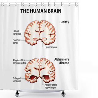 Personality  The Human Brain.  Shower Curtains