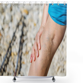 Personality  Painful Varicose Veins Shower Curtains