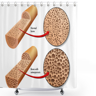 Personality  Colorful Osteoporosis Scheme Shower Curtains