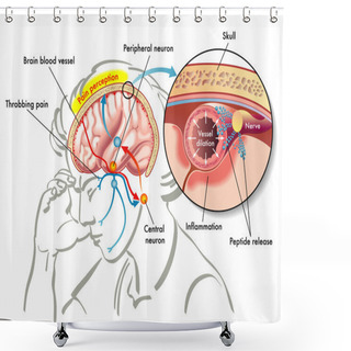 Personality  Colorful Migraine Scheme Shower Curtains