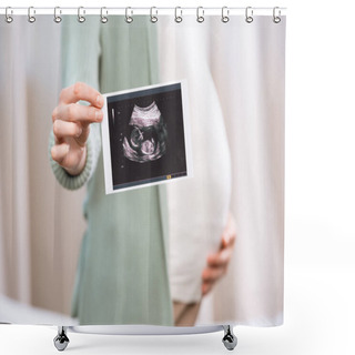 Personality  Pregnant Woman Holding Scan Of Baby 3 Shower Curtains