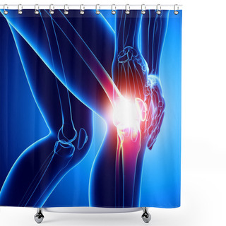 Personality  Female Knee Pain In Blue Shower Curtains