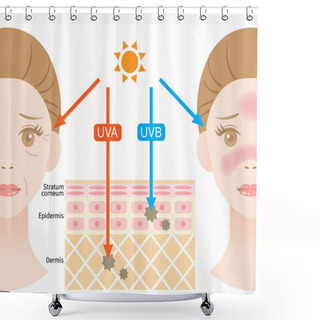 Personality  Infographic Illustration Of Difference Between UVA And UVB Rays. UV Penetration Into Human Skin And Woman Face. Skin Care And Beauty Concept Shower Curtains
