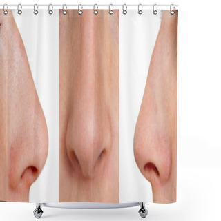 Personality  Aquiline Nose Shower Curtains