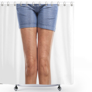 Personality  Fat And Cellulite On The Legs. Shower Curtains