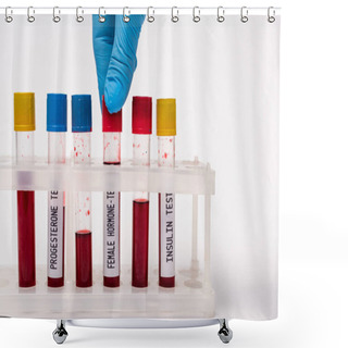 Personality  Cropped View Of Doctor Holding Blood Sample Of Female Hormone Test Near Test Tubes In Stand On White Background Shower Curtains
