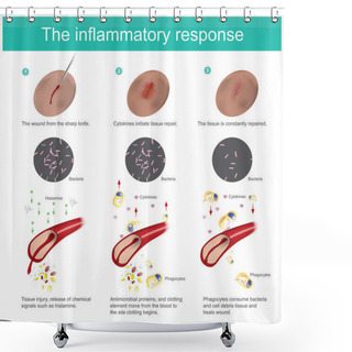 Personality  The Inflammatory Response. When The Skin Tissue Is Damaged, The Body Will Produce Immunity, Eliminate Bacteria, Together With The New Tissue Regeneration Process. All The Response Caused By Blood Vessel And Cells Fluid In The Arteries. Shower Curtains