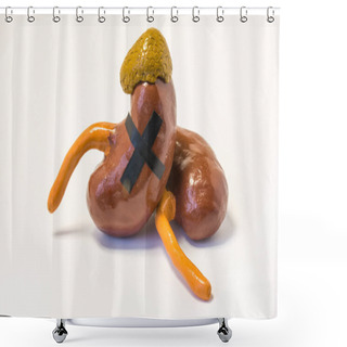 Personality  Anatomical Model Of The Kidneys And Adrenal Glands Pasted A Big Black Cross On Them. Concept Photo Signifying Failure Kidney Function Or Adrenal Hormonal Insufficiency, Organ Death, Terminal Illness Shower Curtains