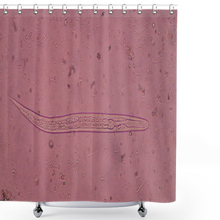 Personality  Strongyloides Stercoralis (threadworm) In Stool, Shower Curtains
