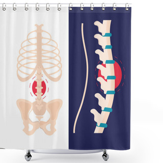 Personality  Arthritis Rheumatology Spine Shower Curtains