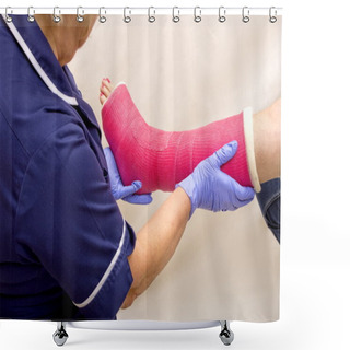 Personality  Ladies Leg In Cast Being Treated By A Nurse Shower Curtains
