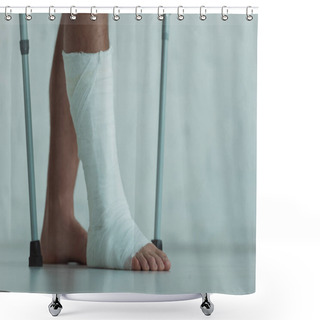 Personality  Cropped View Of Man With Gypsum On Leg Holding Crutches  Shower Curtains