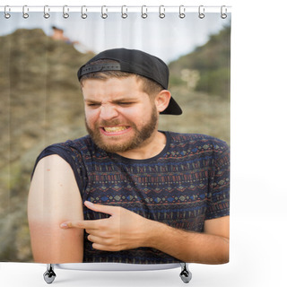 Personality  Man Suffering A Sun Burn In The Arm Shower Curtains