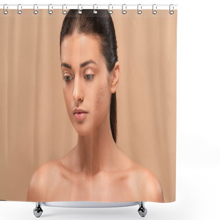 Personality  Young Naked Woman With Problem Skin Isolated On Beige  Shower Curtains