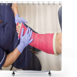 Personality  Ladies Leg In Cast Being Treated By A Nurse Shower Curtains