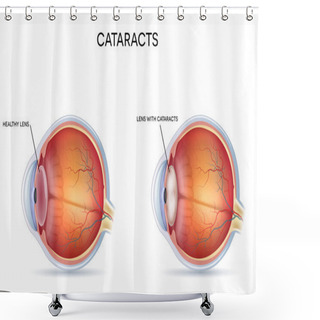 Personality  Cataracts Shower Curtains