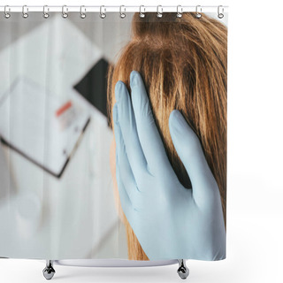 Personality  Cropped View Of Dermatologist In Blue Latex Glove Examining Hair Of Patient In Clinic  Shower Curtains