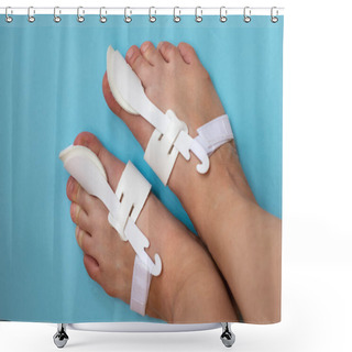 Personality  Bunion Corrector Of A Big Toe, Bunion Relief Protector, Nonsurgerocal Treatment Of A Thumb Deformaty Also Known As Hallux Valgus Shower Curtains