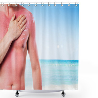 Personality  Man With A Sunburn Shower Curtains