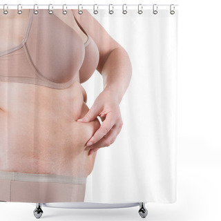 Personality  Tummy Tuck, Flabby Skin On A Fat Belly, Plastic Surgery Concept Shower Curtains