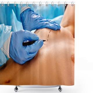 Personality  Doctor Makes Dotted Line On Female Breast . Shower Curtains