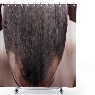 Personality  Psoriasis Skin Shower Curtains