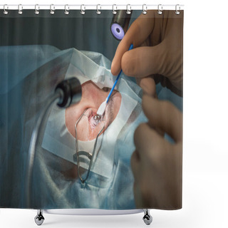 Personality  Flap Raising During Lasik Operation. (one Of 7 Shots) Shower Curtains