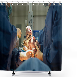 Personality  Baby Being Born Via Caesarean Section Shower Curtains