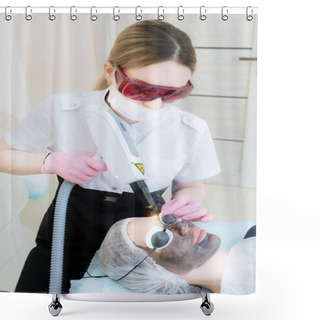 Personality  The Cosmetician Girl In Goggles Makes The Procedure Of Carbon Peeling With The Help Of A Cosmetology Laser. Carbon Face Peeling Procedure. Laser Pulses Clean Skin Of The Face. Hardware Cosmetology Shower Curtains