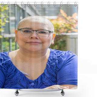 Personality  Cancer Patient Deals With Hair Loss Shower Curtains