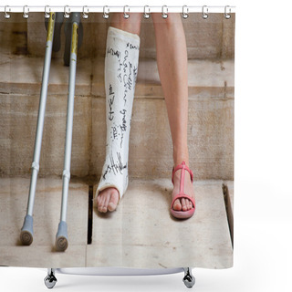 Personality  Woman With Leg In Plaster Shower Curtains