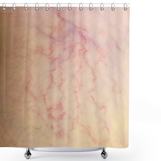 Personality  Varicose Veins Shower Curtains
