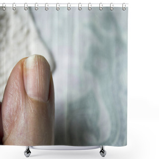 Personality  Toenail With Fungus Shower Curtains