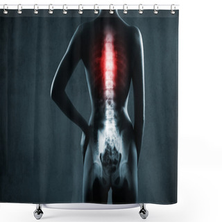 Personality  Human Spine In X-ray Shower Curtains