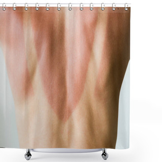 Personality  Close-up Of A Sunburn Marks On A Woman's Back Shower Curtains