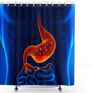 Personality  Gastric Acid Shower Curtains