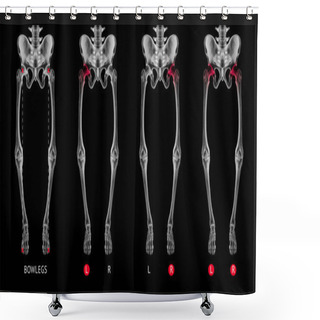 Personality  Varus Alignment Of Leg Or Bowlegs Bone X-ray Film Collection With Red Highlights On Hip Arthritis And Hip Joint Area-Healthcare-Human Anatomy And Medical Concept-Isolated On Black Background. Shower Curtains