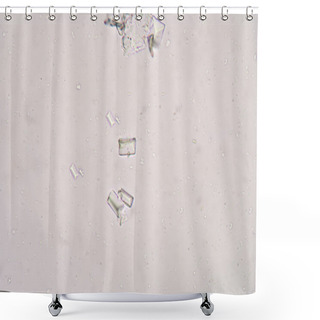 Personality  Tripple Phosphet Crystal In Urine Analysis. Shower Curtains