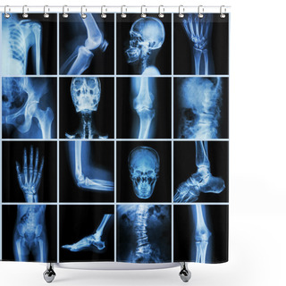 Personality  Collection Human Joint ( Skull Head Neck Shoulder Chest Thorax Shoulder Arm Elbow Forearm Wrist Hand Finger Palm Spine Back Pelvis Thigh Knee Leg Foot Ankle Toe) Shower Curtains