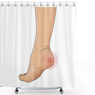 Personality  Female Legs Barefoot, Side View. Vector Illustration, Hand Drawn Cartoon Style Isolated On White. Shower Curtains