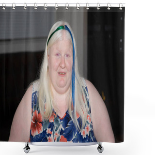 Personality  Albino Woman Wearing Green And Blue Streaks In Her Hair Shower Curtains