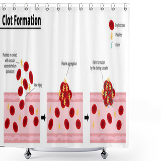 Personality  Clot Formation Process After A Bleeding Vascular Injury. Platelet Aggregate Formation. Formation Of Fibrin By The Clotting Cascade. Vector Illustration. Didactic Illustration. Shower Curtains