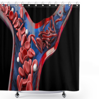 Personality  Sickle Cell Anemia, Showing Blood Vessel With Normal And Deformated Crescent. 3D Illustration Shower Curtains