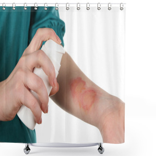 Personality  Treatment Of Burns By Spray On Female Hand Isolated On White Shower Curtains