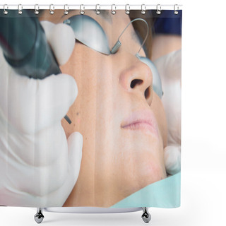 Personality  Asian Woman Patient On Laser Procedure Skin Resurfacing In Aesthetic Medicine. Shower Curtains