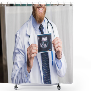 Personality  Doctor Holding Ultrasound Scan  Shower Curtains